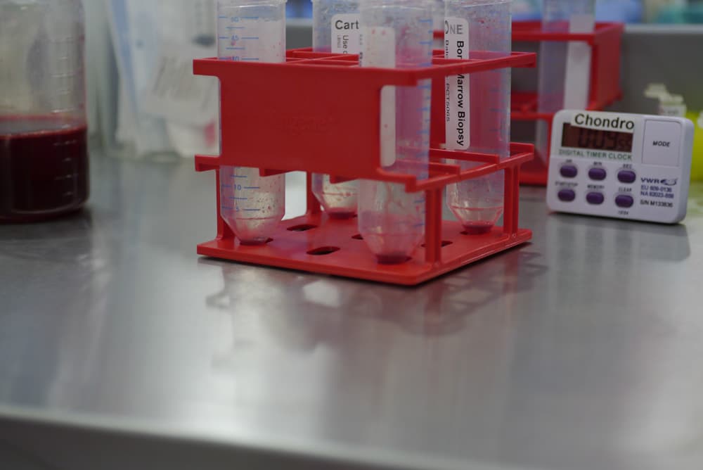 Regenerative cartilage tissue at London Cartilage Clinic